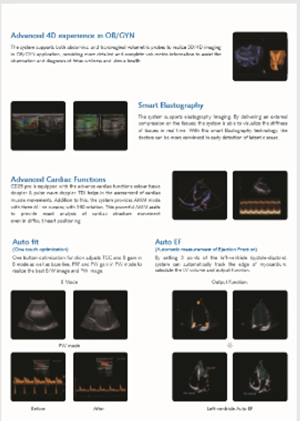 Konica Minolta 3D-4D Color Doppler Konica Model AeroScan CD-25PRO - Static